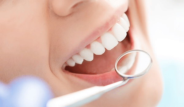 Dental-InternalImage